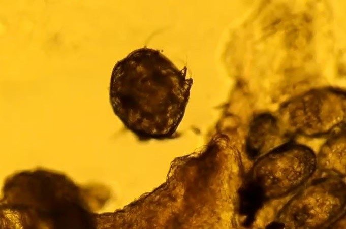 Duştan sonra şiddetli kaşınanlar dikkat! Uyuzun habercisi olabilir