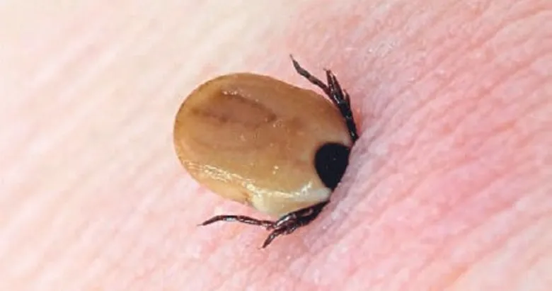 Sağlık Bakanlığı’ndan kene uyarısı: Çıplak elle müdahale etmeyin