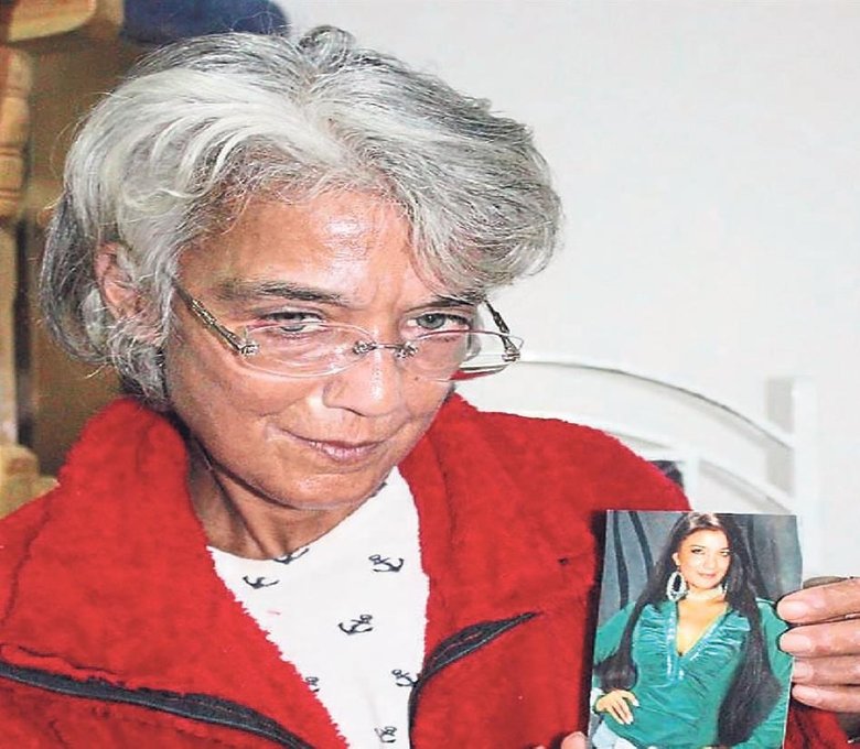Güzel modacı 6 ayda tanınmayacak hale geldi