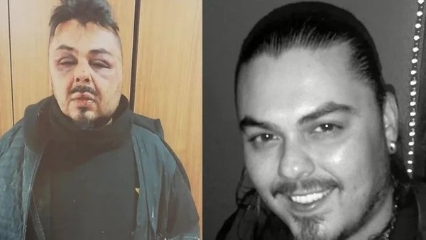 DM’den yürüyen şarkıcının kemiklerini çatır çatır kırdılar! Artık tanınmaz halde...