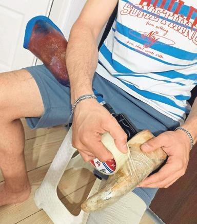 Koli bandıyla gelen madalya