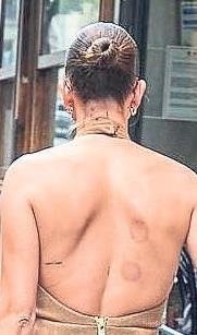 Hailey’in hacamat izleri