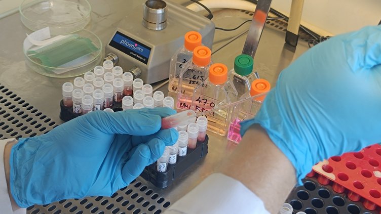 Manisa hastalık riskiyle karşı karşıya! Ölümcül olabilir