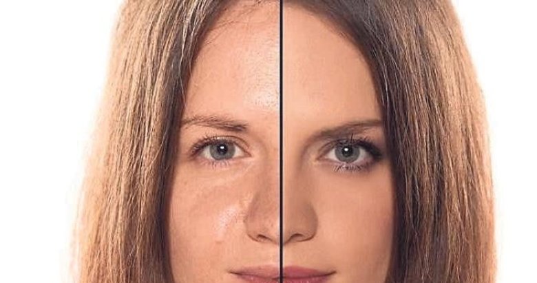 Yağlı ciltler için ideal beslenme