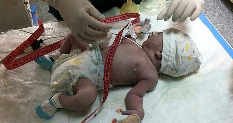 Ömer bebek sadece 17 gün yaşayabildi