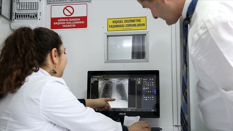 Tüberküloz nedir? Tüberküloz bulaşıcı mı? Tüberküloz tedavisi nasıl?