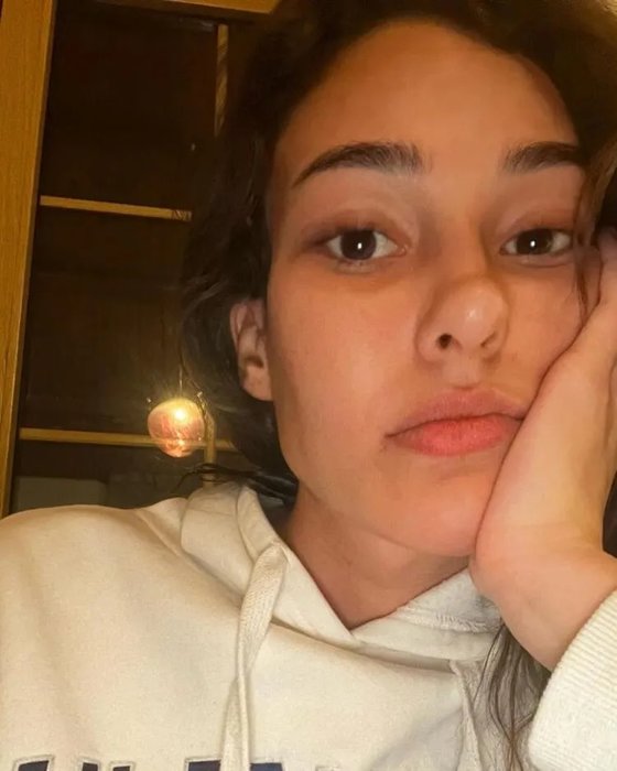 Dilan Çiçek Deniz estetik söylentilerine isyan etti!