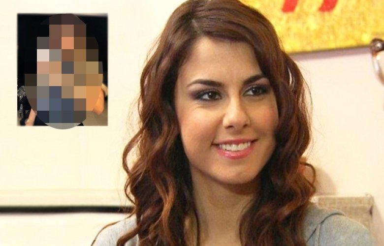 Adanalı dizisinin Pınar�ı Tuğçe Özbudak estetikli haliyle tanınmaz hale