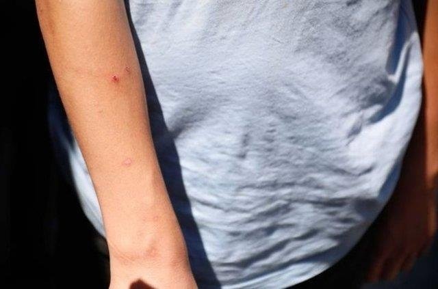 İzmir'de sivrisinek alarmı: Uzmanlar özellikle bu türe karşı hamileleri uyardı