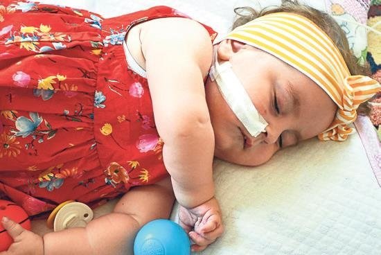 SMA’lı bebekler tedavi ile gülüyor