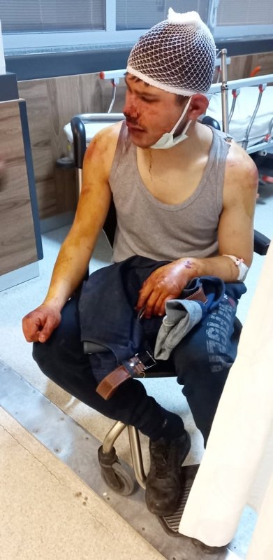 Afyonkarahisar’da çırağını saatlerce döven patron tutuklandı