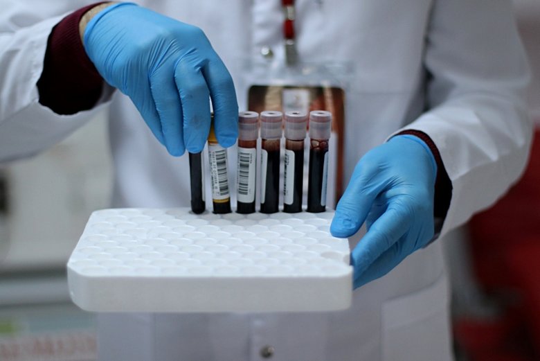 Kan grubu ve koronavirüs arasında bağlantı var mı? Bilim insanları açıkladı