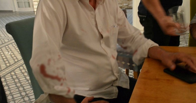 CHP’li Didim Belediye Başkanı Atabay ve avukatına beyzbol sopalı saldırı