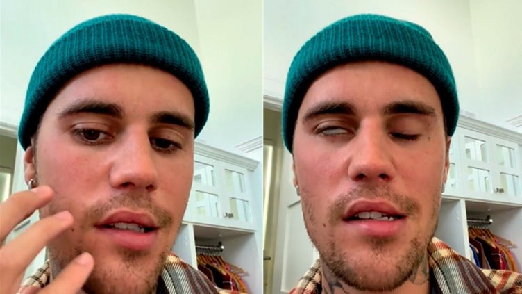 Justin Bieber: Hastalığım kötüye gidiyor!