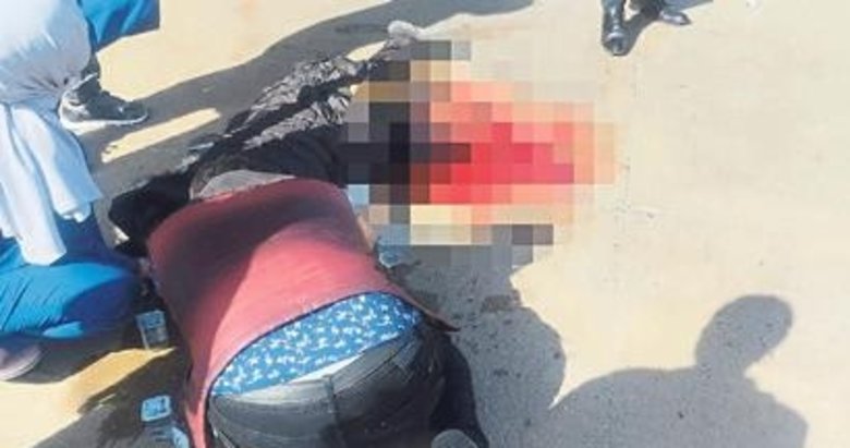 Otobüs hamile kadının bacağını kopardı