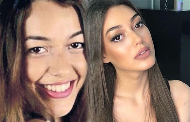 Çukur dizisinin Sena’sı Dilan Çiçek Deniz’in estetiksiz hali şoke etti Ünlülerin