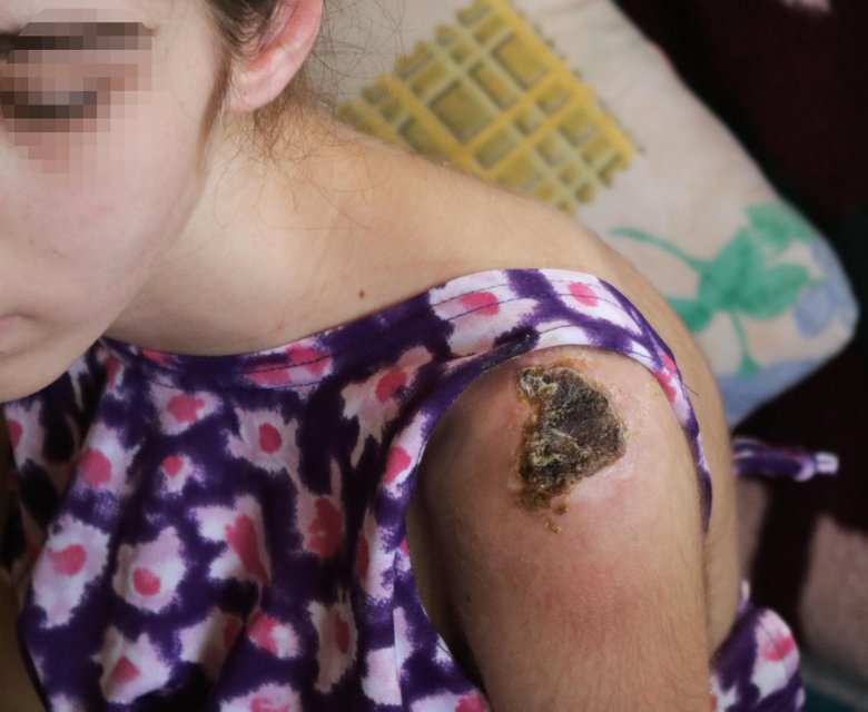 İzmir Foça’da kan donduran iddia! Üvey babadan iki kardeşe keser sapıyla şiddet