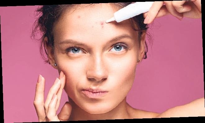 Akne sorunuyla gençliğinizi gölgelemeyin