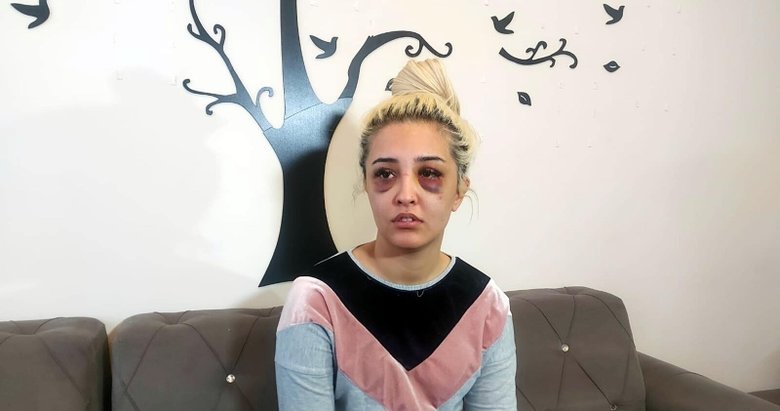Ayrılmayı kabul etmeyen sevgilisi dehşeti yaşatmıştı! İzmir’deki davada cinsel saldırı iddiası
