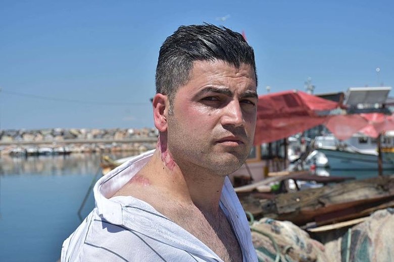 Lazer tedavisi sonrası hayatı karardı! Soluğu mahkemede aldı