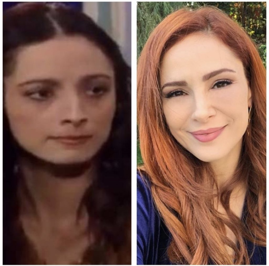 dogdugun ev kaderindir in zeynep i demet ozdemir estetiksiz halini gorenler taniyamadi galeri yeni asir