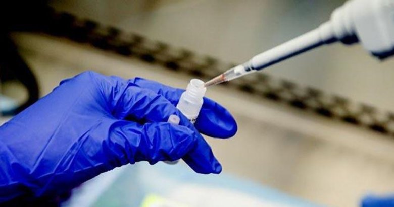 Izmir De Koronavirus Testi Yapan Hastaneler Hanginleri Nerede Korona Testi Yaptirilir