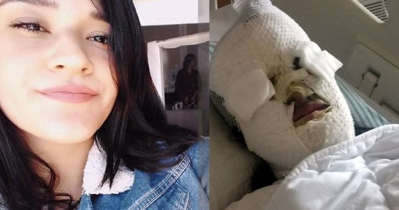 Hatay’da Berfin Özek’in yüzüne asit döken sanığın cezası belli oldu