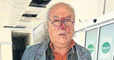CHP’li belediye korumalarından gazeteci Yüksel Kalkan’a saldırı