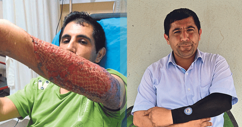 Hayatı 3 dikişle kabusa döndü