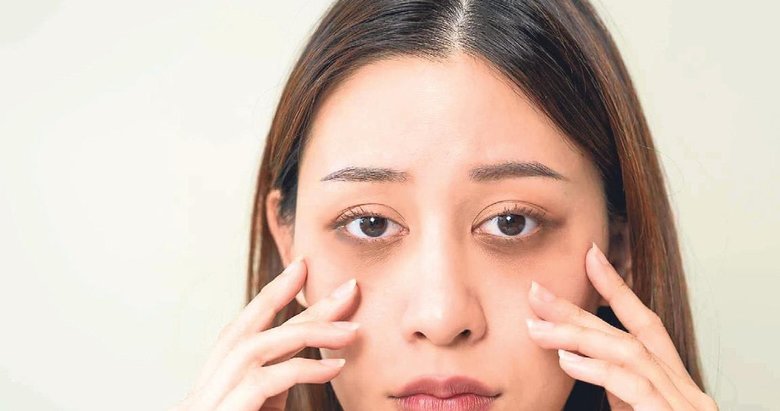 Göz altı morluklarının bilinmeyen nedenleri