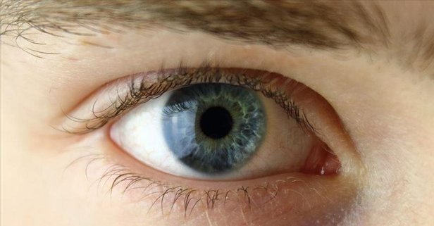 Göz tansiyonu Glokom nedir? Belirtileri nelerdir? Kimlerde görülür?