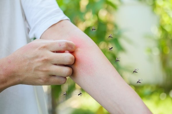 Ev yapımı kreminizi sürün: Sivrisineklerden kurtulun!