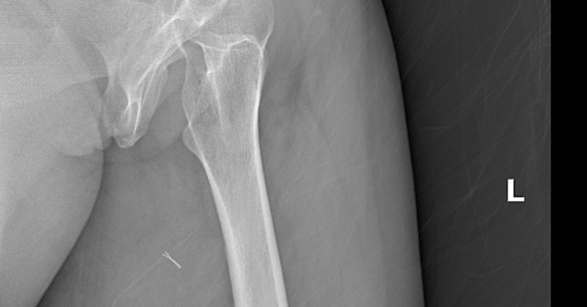 Diyarbakır'da şoke eden olay! Hastanın vücudundan öyle bir şey çıktı ki…