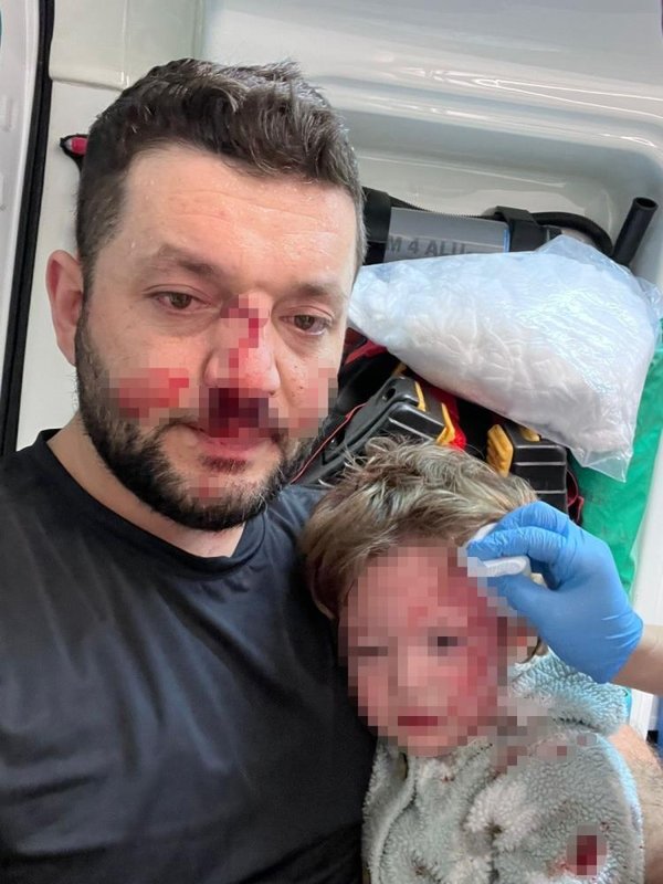 Baba ve 14 aylık kızına saldırmıştı: Hakkında istenen ceza belli oldu!