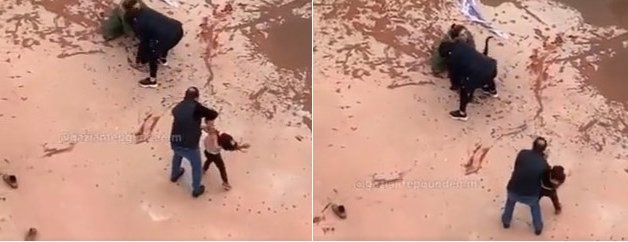 Pitbull’un saldırdığı 4 yaşındaki Asiye yaşam savaşı veriyor