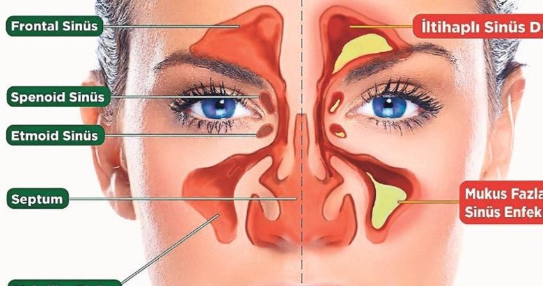 Endoskopik sinüs cerrahisi hastaya konfor sunuyor
