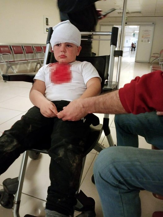 İzmir’de pitbull dehşeti! Küçük çocuğu hastanelik etti