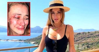 ‘Kariyerim bitti sandım’