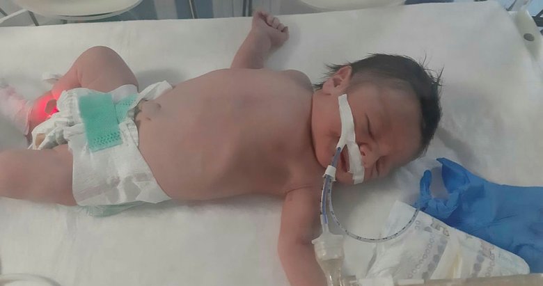 Kalp damarları ters olan Leo bebek İstanbul’a getirildi