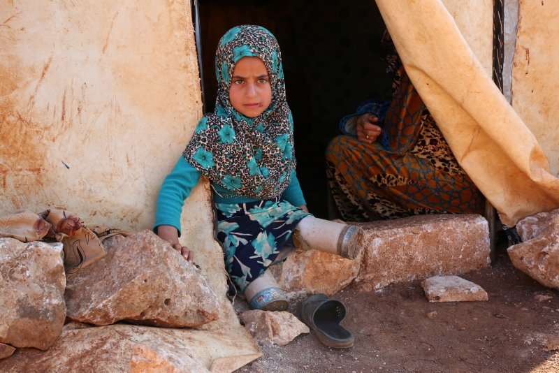 Doğarken bacaklarının dizden altını kaybeden 8 yaşındaki Suriyeli Maya Meri okula konserve kutusundan ayaklarıyla gidiyor