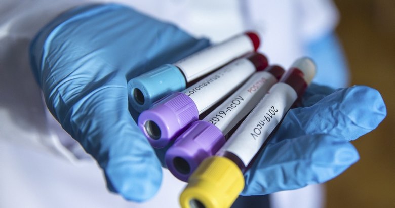 Çin’de Kovid-19 nedeniyle ölenlerin sayısı 1771’e yükseldi