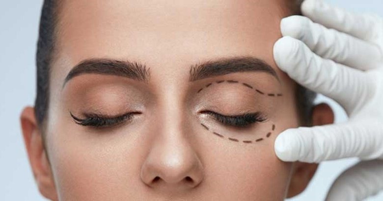 Göz çevresi estetiği bütün olarak ele alınmalı