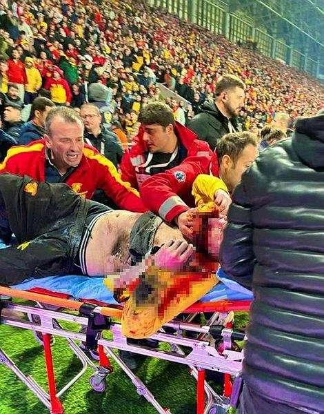 Olaylı Göztepe-Altay maçı sonrası ambulans şirketiyle ilgili soruşturma derinleştirildi! Yaşananlar sonrası son durum