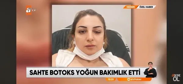 botoks-yaptirmak-isterken-hayatlarindan-olacaklardi-7-kadin-guzellik-ugruna-yogun-bakimlik-oldu-1790841322093.png