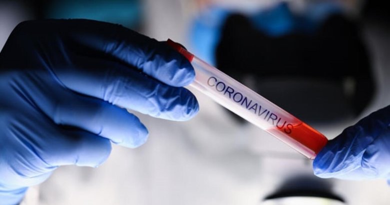 Son dakika: 8 Mayıs koronavirüs tablosu paylaşıldı