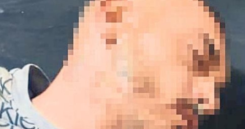 Kadına şiddet ihbarına giden polisi bıçakladı