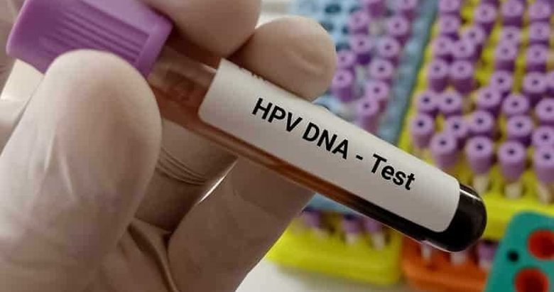 Pozitif çıkan HPV testi kanser anlamı taşımaz