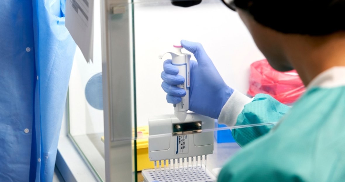Yurt Disina Cikislarda Pcr Testi Istenen Vatandaslar Icin Test Ucreti Belli Oldu Ekonomi Haberleri