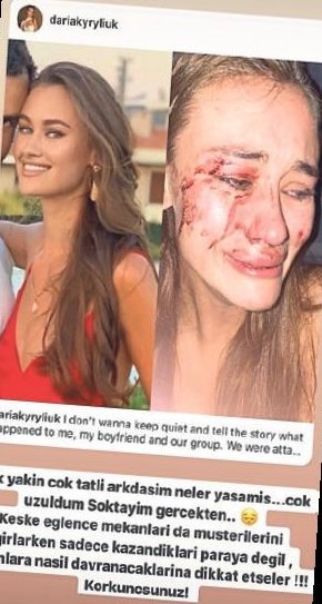 Kim dövdü bilmiyorum