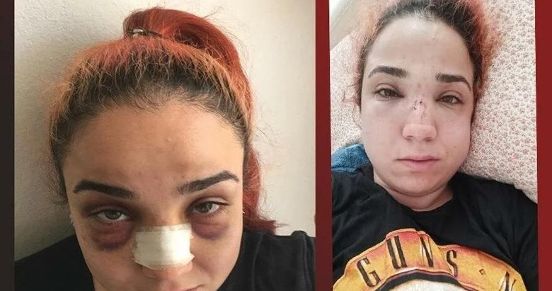 İzmir’de telefonda konuşuyor diye kadın çalışanına tavayla saldırıp burnunu kırdı
